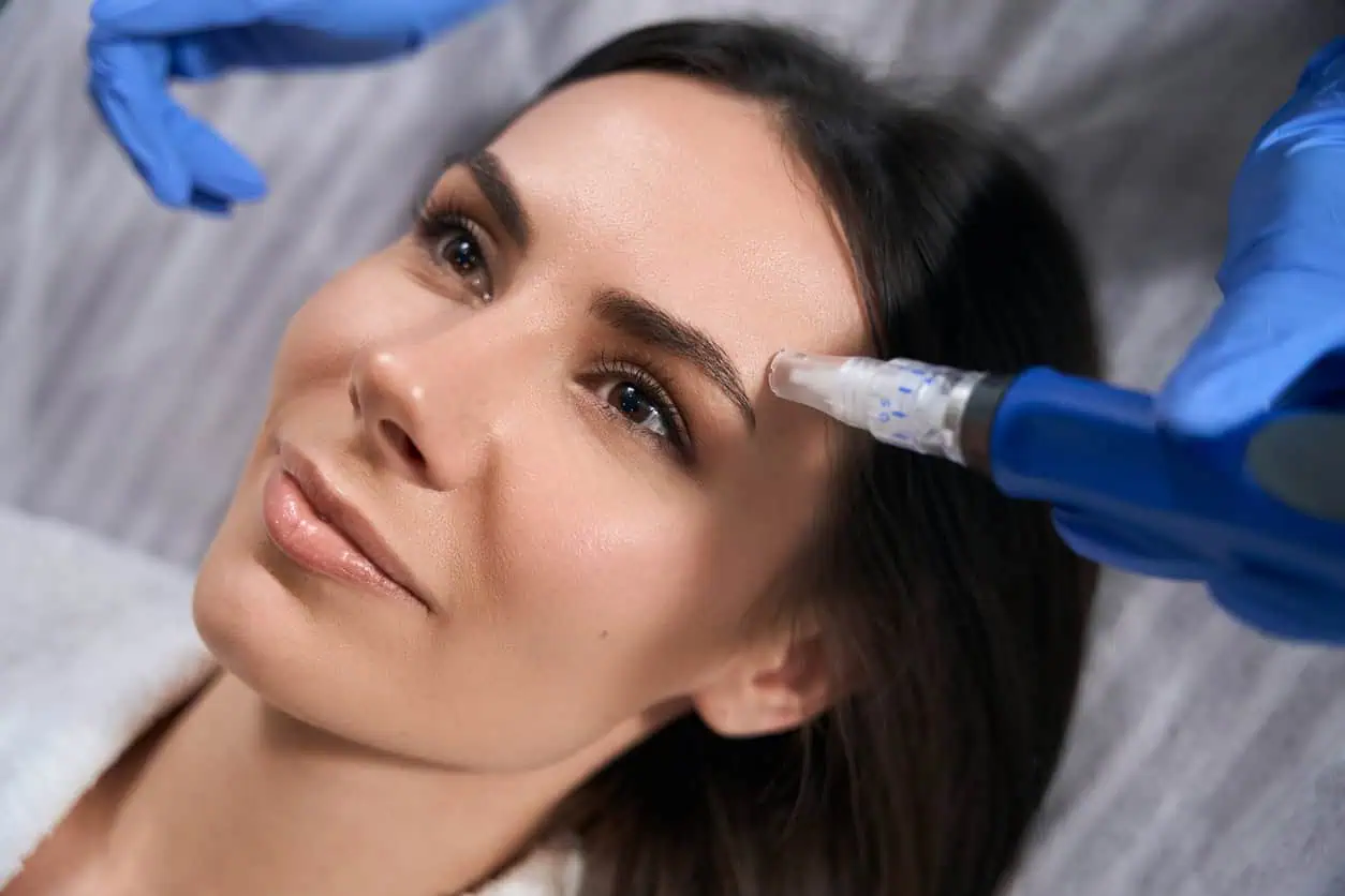 Microneedling at Divine MedSpa | Ormond Beach, FL