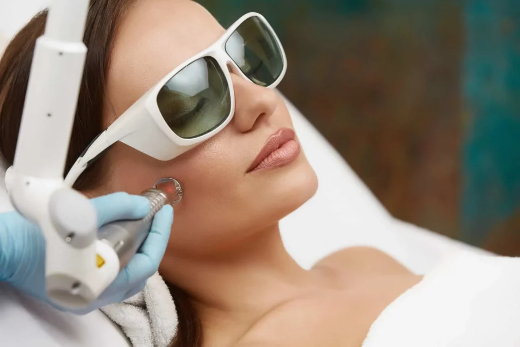 Woman getting Picoway Fractional Laser Treatment at Divine MedSpa