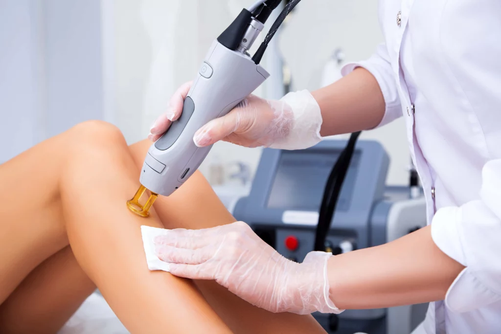 Laser Hair Removal in Ormond Beach FL Divine MedSpa