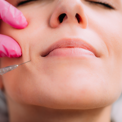 Girl getting Nasolabial fold filler at Divine MedSpa | Ormond Beach