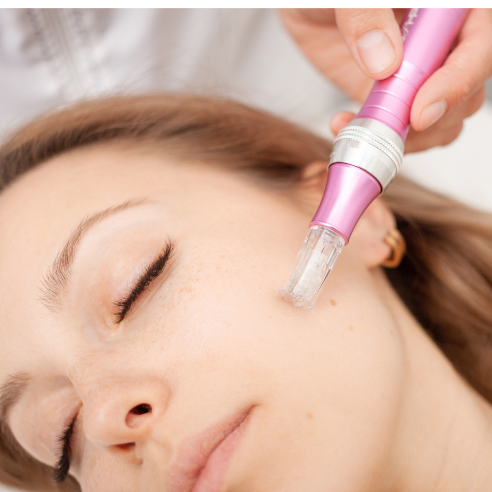 Lady getting microneedling with exosomes at Divine MedSpa | Ormond Beach