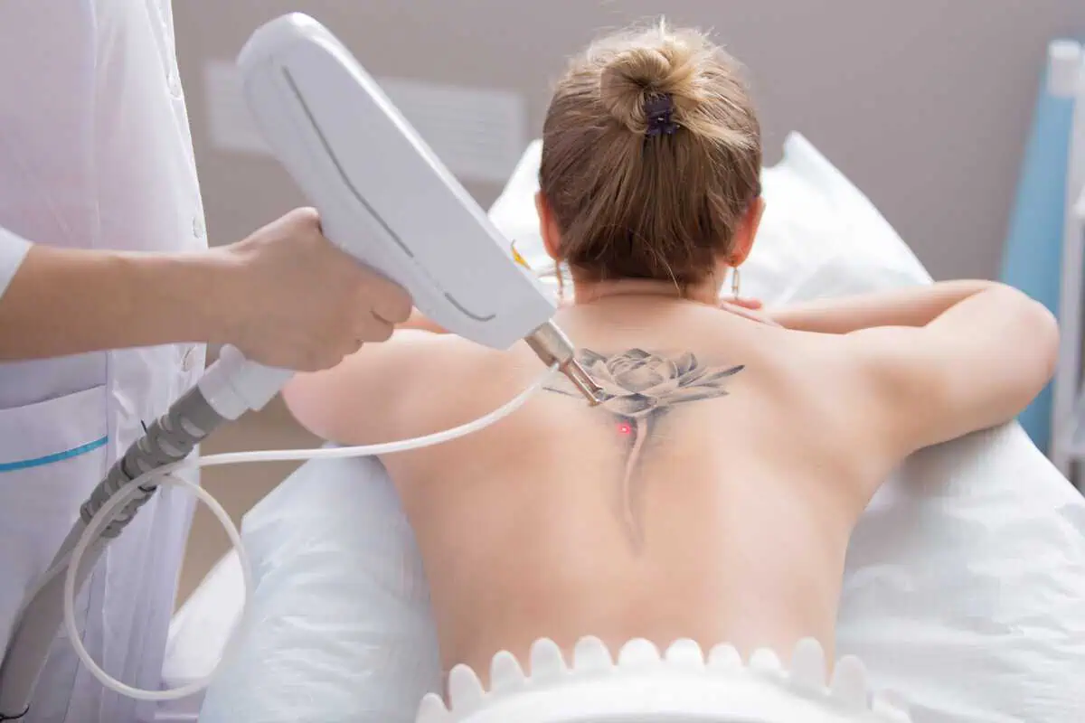 Benefits of Laser Hair Removal Divine MedSpa