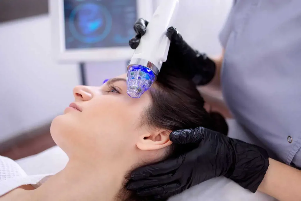 RF Microneedling Ormond Beach FL Divine Laser MedSpa