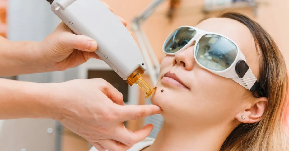 Women receiving BBLHERO inOrmondBeachFL