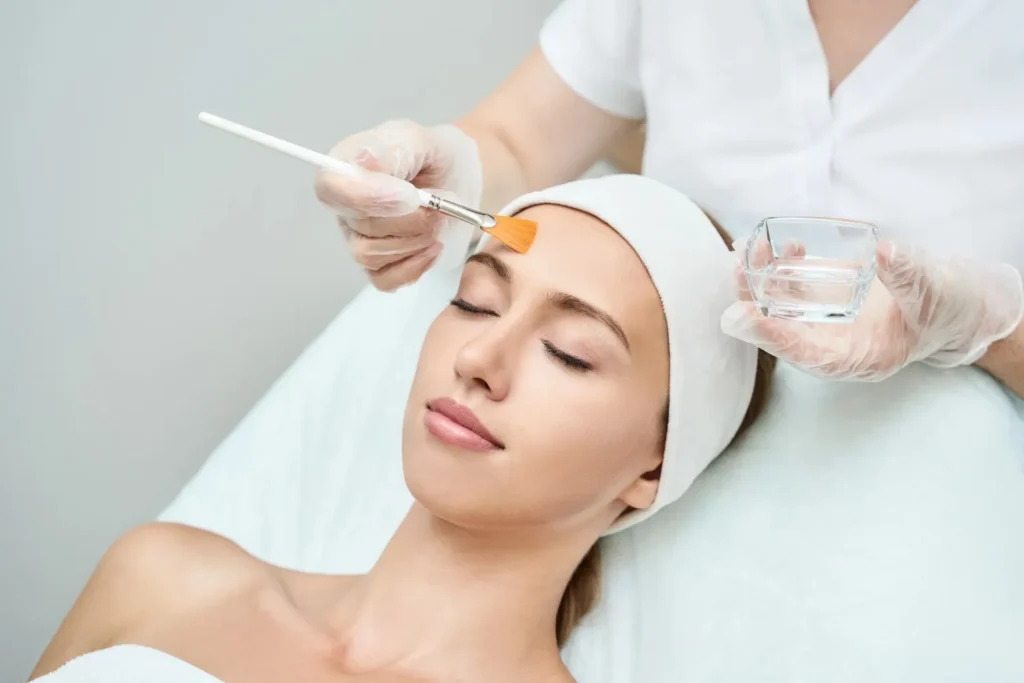 VI Peel for Treating Adult Acne and Acne Scars