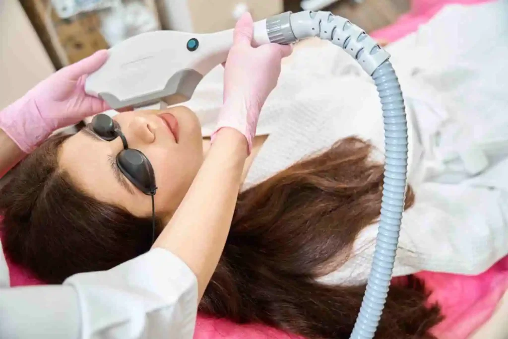 Woman wearing protective eyewear while receiving an IPL photofacial treatment for sun damage and skin pigmentation